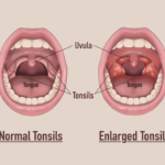 can tonsils grow back